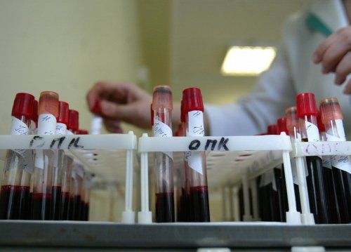 Анализ крови на гемоглобин и количество эритроцитов - одно из важнейших исследований